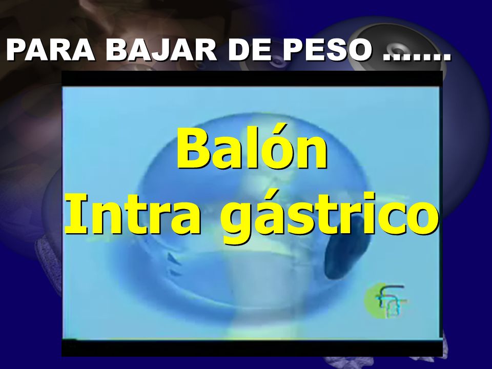 Resultado perdida de peso balon intragastrico a seis meses